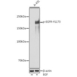 Phospho-EGFR-Y1173 Rabbit pAb