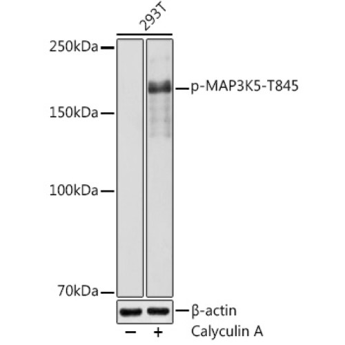 Phospho-MAP3K5-T845 Rabbit pAb