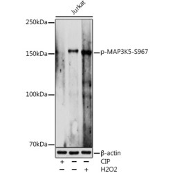 Phospho-MAP3K5-S967 Rabbit pAb