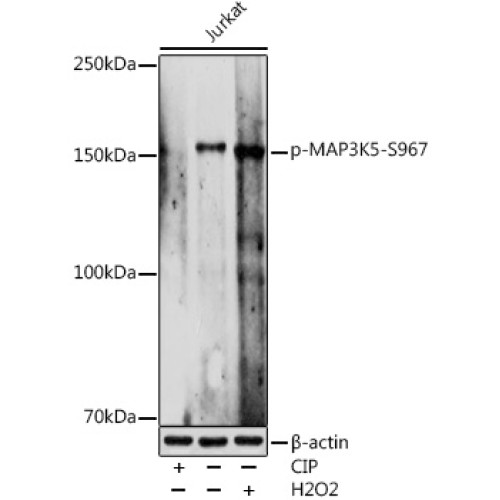 Phospho-MAP3K5-S967 Rabbit pAb