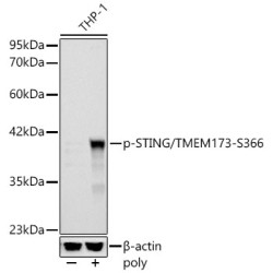 Phospho-STING/TMEM173-S366 Rabbit pAb