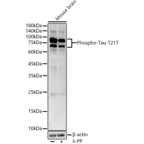 Phospho-Tau-T217 Rabbit pAb