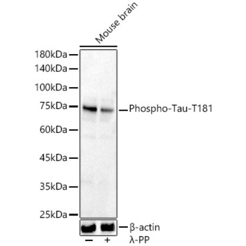 Phospho-Tau-T181 Rabbit pAb