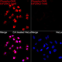 Phospho-PKR/EIF2AK2-T446 Rabbit pAb