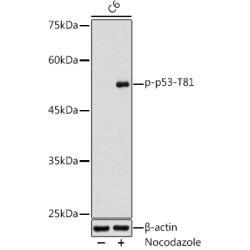Phospho-p53-T81  Rabbit pAb