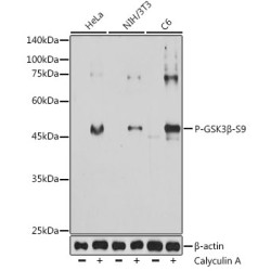 Phospho-GSK3β-S9 Mouse mAb