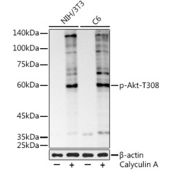 Phospho-Akt-T308 Rabbit mAb