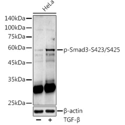 Phospho-Smad3-S423/S425 Rabbit pAb