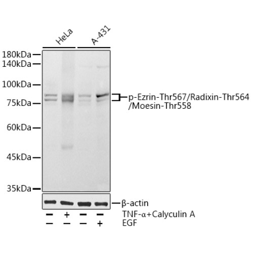 Phospho-Ezrin-Thr567/Radixin-Thr564/Moesin-Thr558 Rabbit pAb