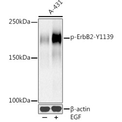 Phospho-HER2/ErbB2-Y1139 Rabbit mAb