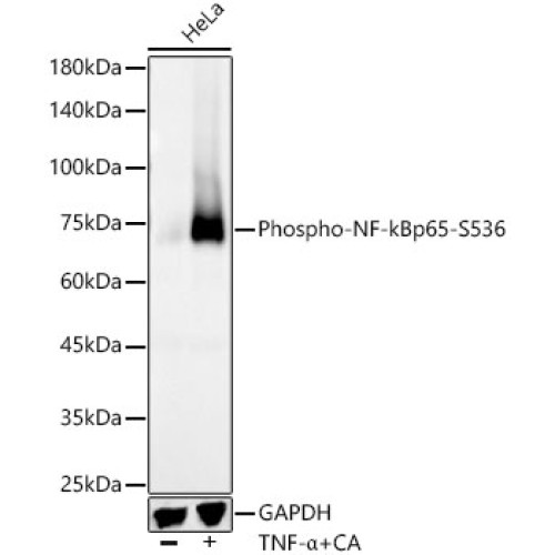 Phospho-NF-kB p65/RelA-S536 Rabbit mAb
