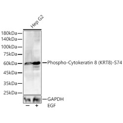 Phospho-Cytokeratin 8 (KRT8)-S74 Rabbit pAb