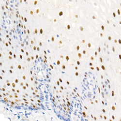 Phospho-Nucleolin-T76 Rabbit mAb