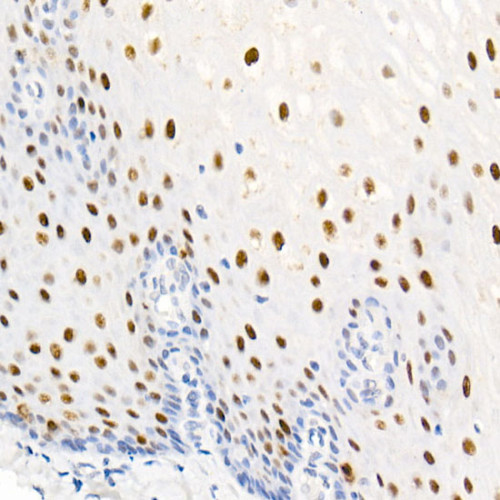 Phospho-Nucleolin-T76 Rabbit mAb