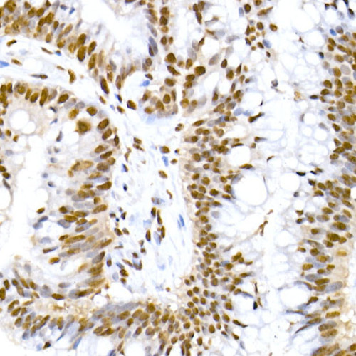 Phospho-MDM2-S166 Rabbit mAb