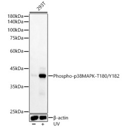 Phospho-p38 MAPK-T180/Y182 Rabbit mAb