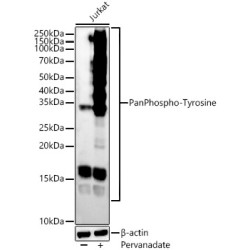 Pan Phospho-Tyrosine Rabbit mAb