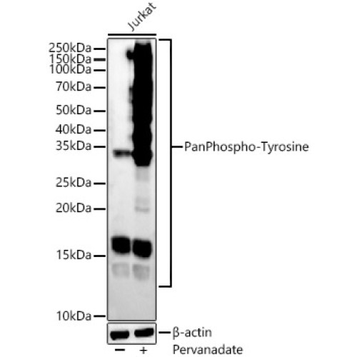 Pan Phospho-Tyrosine Rabbit mAb