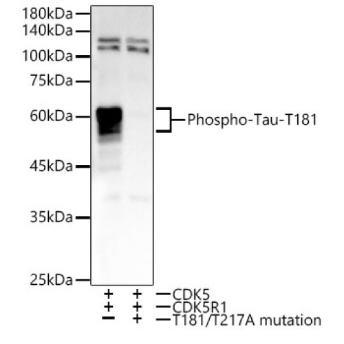 Phospho-Tau-T181 Rabbit mAb