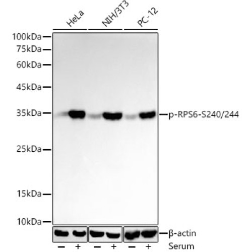 Phospho-S6 Ribosomal Protein (RPS6)-S240/244 Rabbit mAb