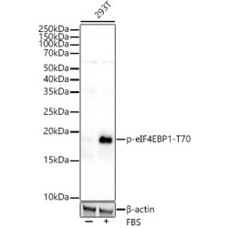Phospho-eIF4EBP1-T70 Rabbit mAb