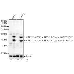 Phospho-JNK1-T183/Y185 + JNK2-T183/Y185 + JNK3-T221/Y223 Rabbit mAb