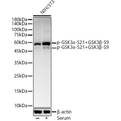 Phospho-GSK3α-S21+GSK3β-S9 Rabbit mAb