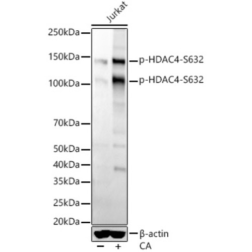 Phospho-HDAC4-S632 Rabbit mAb