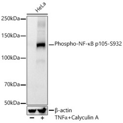 Phospho-NF-κB p105-S932 Rabbit mAb