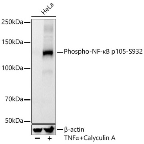 Phospho-NF-κB p105-S932 Rabbit mAb