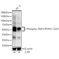 Phospho-PDK1/PDPK1-S241 Rabbit mAb