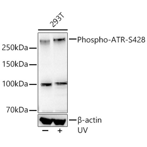 Phospho-ATR-S428 Rabbit mAb