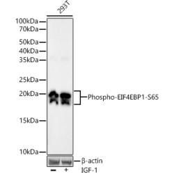 Phospho-eIF4EBP1-S65 Rabbit mAb