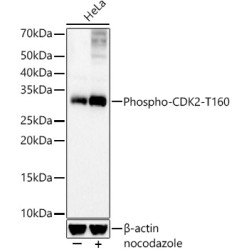 Phospho-CDK2-T160 Rabbit mAb