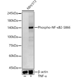 Phospho-NF-κB2-S866 Rabbit mAb