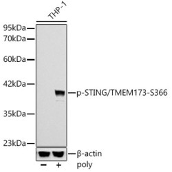 Phospho-STING/TMEM173-S366 Rabbit mAb