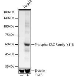 Phospho-SRC Family-Y416 Rabbit mAb