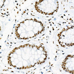 Phospho-p38 MAPK-Y182 Rabbit mAb