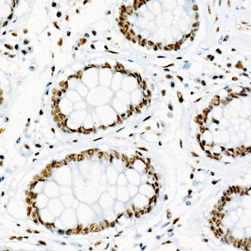 Phospho-p38 MAPK-Y182 Rabbit mAb