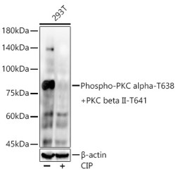 Phospho-PKC alpha-T638 + PKC beta II-T641 Rabbit mAb
