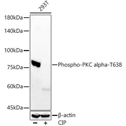 Phospho-PKC alpha-T638 Rabbit mAb