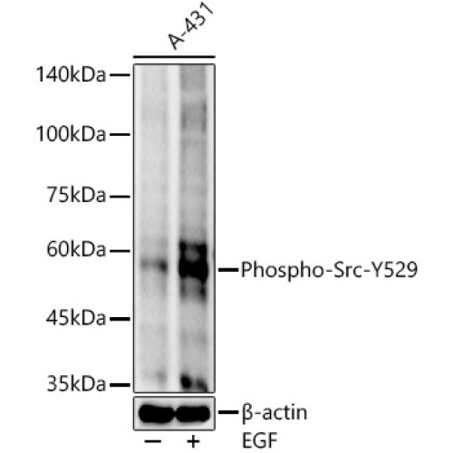 Phospho-Src-Y529 Rabbit mAb