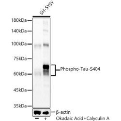Phospho-Tau-S404 Rabbit mAb