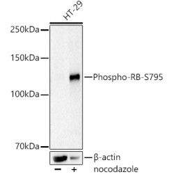 Phospho-RB-S795 Rabbit mAb
