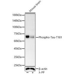 Phospho-Tau-T181 Rabbit mAb