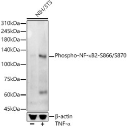 Phospho-NF-κB2-S866/S870 Rabbit mAb