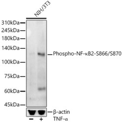 Phospho-NF-κB2-S866/S870 Rabbit mAb