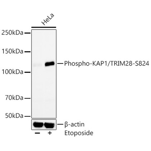 Phospho-KAP1/TRIM28-S824 Rabbit mAb