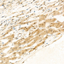 phospho-YAP1-S127 Rabbit mAb