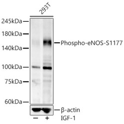 Phospho-eNOS-S1177 Rabbit mAb